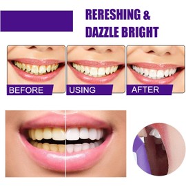 Purple Toothpaste for Teeth Whitening: Best Color-Correcting Foam Toothpaste for Stain Removal - Sensitive Teeth Brightening & Non-Peroxide Whitening - for Adults, 1.5 fl oz (2 Pack)