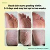 F3 systems, Foot Exfoliation Peeling MASK, Baby Foot Peel, Cracked