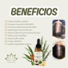 Aceite Capilar Ozonizado Romero Anti-caída de Cabello (30 ML)