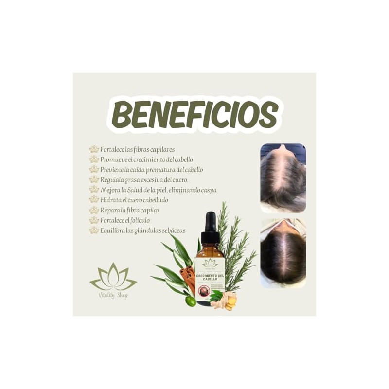 Aceite Capilar Ozonizado Romero Anti-caída de Cabello (30 ML)