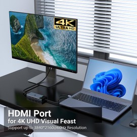 BIGBIG WON Multiport Adapter USB C, 5-in-1 USB C Splitter with HDMI 4K @ 60Hz, 3 x 10Gbps USB 3.2 Gen 2, 100W PD, USB C Hub for Surface and More Type C Devices