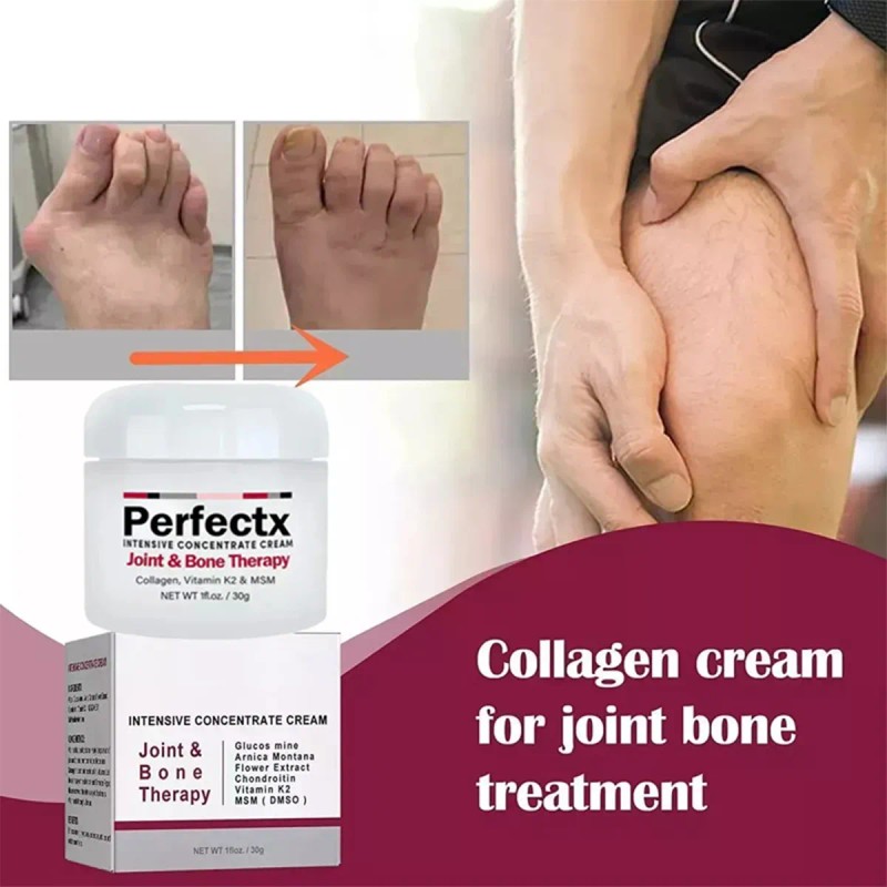 Articulaciones Para Intensiva Ósea Terapia De Crema