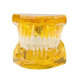 Dental Model with Braces, Transparent Tooth Model, Implant Dental Model, Orthodontic Dental Model, Implant Demo with Removable Crown/Bridge for Training (Yellow)