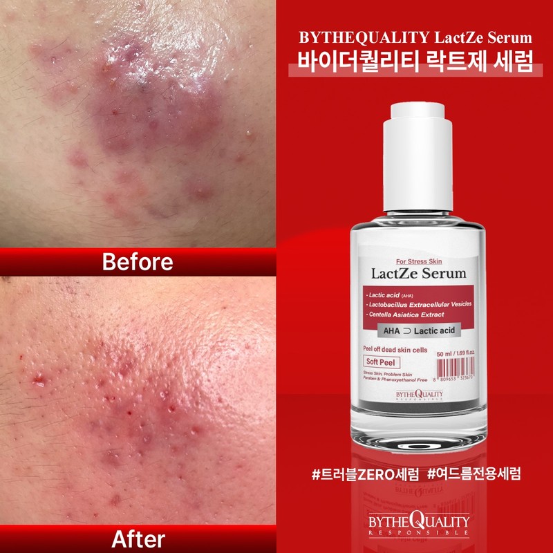 By the Quality Lactje Ampoule Serum 50ml Trouble Millet Sebum