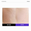 FRANKLY Closer Serum Mega Jumbo | Pore Minimizer Serum |