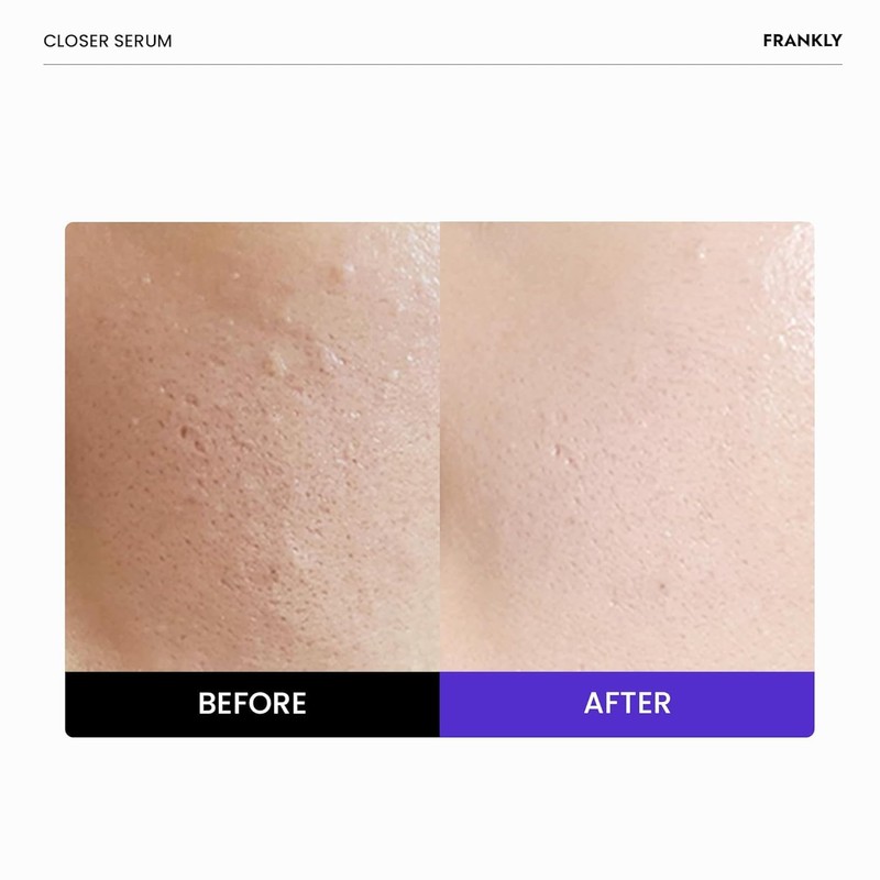 FRANKLY Closer Serum Mega Jumbo | Pore Minimizer Serum |