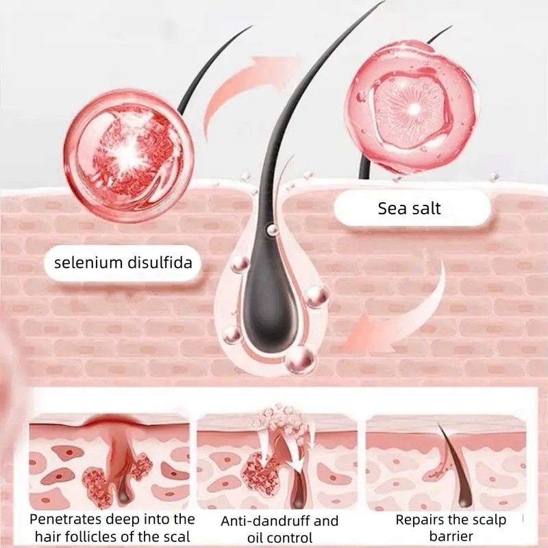 NIPPORI Selenium Disulfide Shampoo – Oil Control, Anti-Dandruff & Anti-Itch