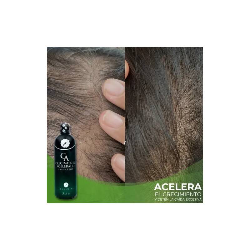 Shampoo Crecimiento Acelerado ( 3 Shampoo )