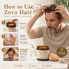 1PCSZova Hair Growth Balm,Deep Scalp Nourishing Hair Treatment