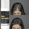 SINYI 2pcs Hair Concealer for Men， Corrector capilar para hombres,