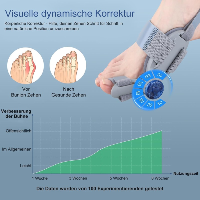 Generisch Hallux Valgus Correction Fixation Plate Upgrade Hallux Valgus Bunion