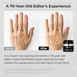 DOMINAS Crema correctora de manchas oscuras | Fórmula avanzada con niacinamida, TXA, hexilresorcinol y bakuchiol para reducir visiblemente las manchas