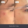 Rescue Balm Post-blemish Recovery Cream from Hero Cosmetics