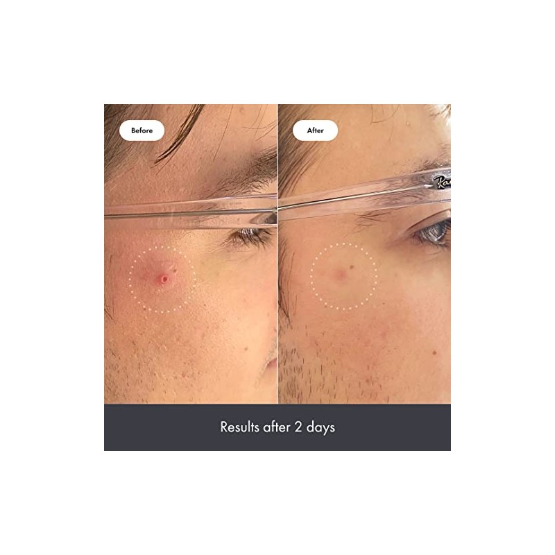 Rescue Balm Post-blemish Recovery Cream from Hero Cosmetics