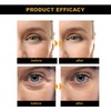 Eye Pads Against Dark Circles, Eye Pads Against Wrinkles, Eye