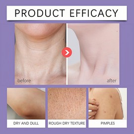 Neck Firming Stick,Firming & Lifting N/eck Cream,Neck Tightening Moisturizer Skin Care,Ne/ck Tightening C/ream,Anti-Wrinkte Sn/ake Oil Nec/k Care Stick,Wrinkle Cr/eam for N/eck,Smooths Neck Creams