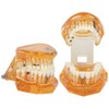 1pc Orange Color Dental Disease Removable Study Teaching Teeth Model