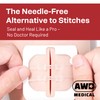 AWD Zip Stitch Wound Closure Strips - 2 Zipstitch Devices,