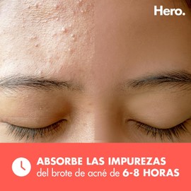 Hero Parches para Acné Mighty Patch Original, Caja con 36 Piezas para Uso de Noche. Absorben las Impurezas en 6 a 8 Horas. Fáciles de Usar y No Contienen Medicamento. Probados Dermatológicamente