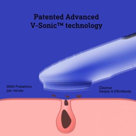 Sonic NågraCoola CLIE Sonic Facial Cleansing Brush Waterproof Electric Face Cleansi...