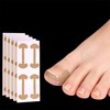 Toe tape band, toenail nail sticker, ingrown toenail care (4 pieces) One set 7ea