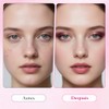 Txa Cream Crema Manchas Faciales Arbutin Aclaramiento Piel Oscuras Pecas