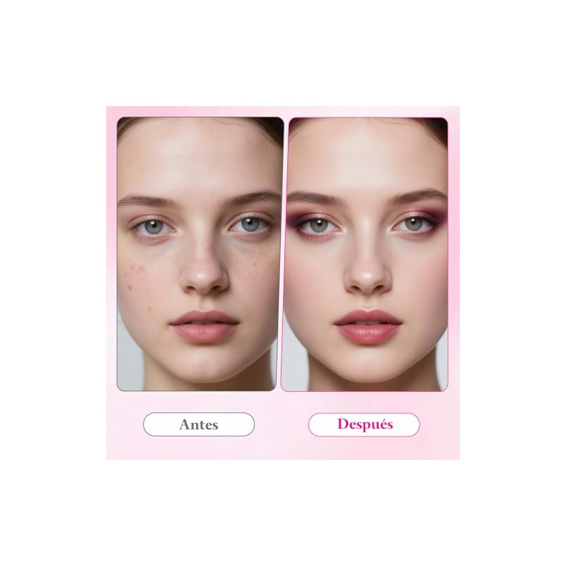 Txa Cream Crema Manchas Faciales Arbutin Aclaramiento Piel Oscuras Pecas
