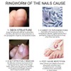 Fungus Nail Repair Pen Toenails, Nail Biological Repair Pencil, Repairs