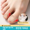 BINEL 발톱무좀밴드 문제성 손발톱 네일 집중케어 BINEL Nail Fungal Infection