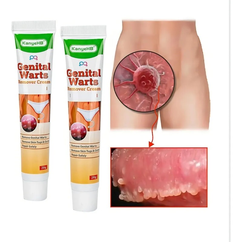 Crema Removedora De Verrugas Genitales Y Zonas Intimas 2 Piezas