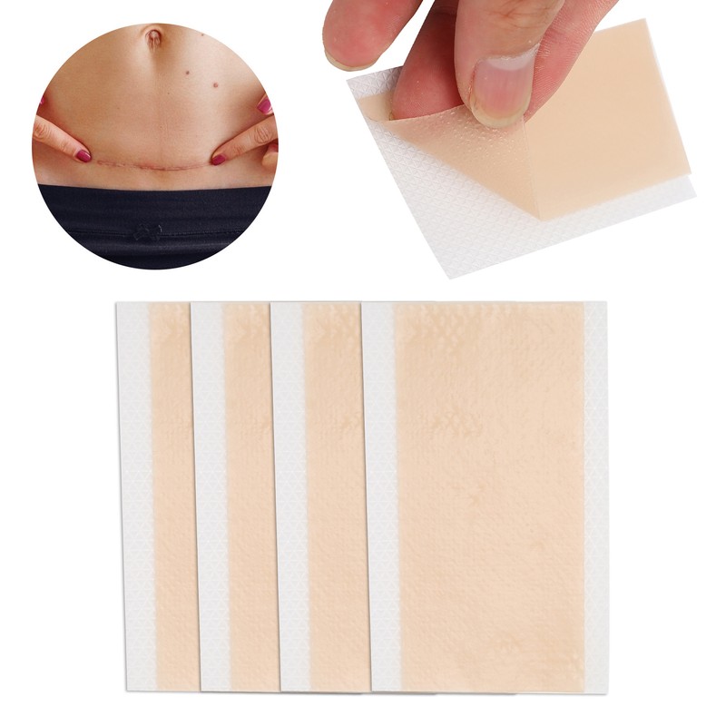 4 Pcs Elaimei Silicone Scar Sheets Stretch Marks Remover Post