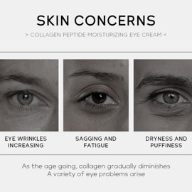 Moisturizing Collagen Peptides Eye Cream, Dark Circle Eye Cream, Anti Wrinkle Eye Cream With Hydrolyzed Collagen, To Reduce Puffiness, Crows Feet And Eye Bags Caffeine Eye Cream, All Skin Types