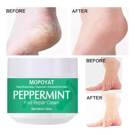 Crema Para Quitar Callos. Remueve Capa X Capa Callos Duros.