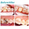 Broken Tooth Repair Kit-Temporary Teeth Replacement Kit for Fixing Filling