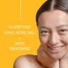 Toque Peróxido De Benzoilo 2,5% Acne Treatment Gel Crema -
