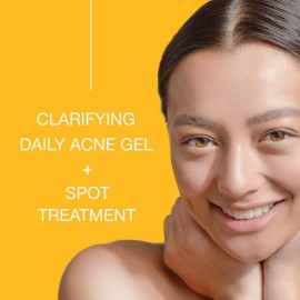 Toque Peróxido De Benzoilo 2,5% Acne Treatment Gel Crema - E