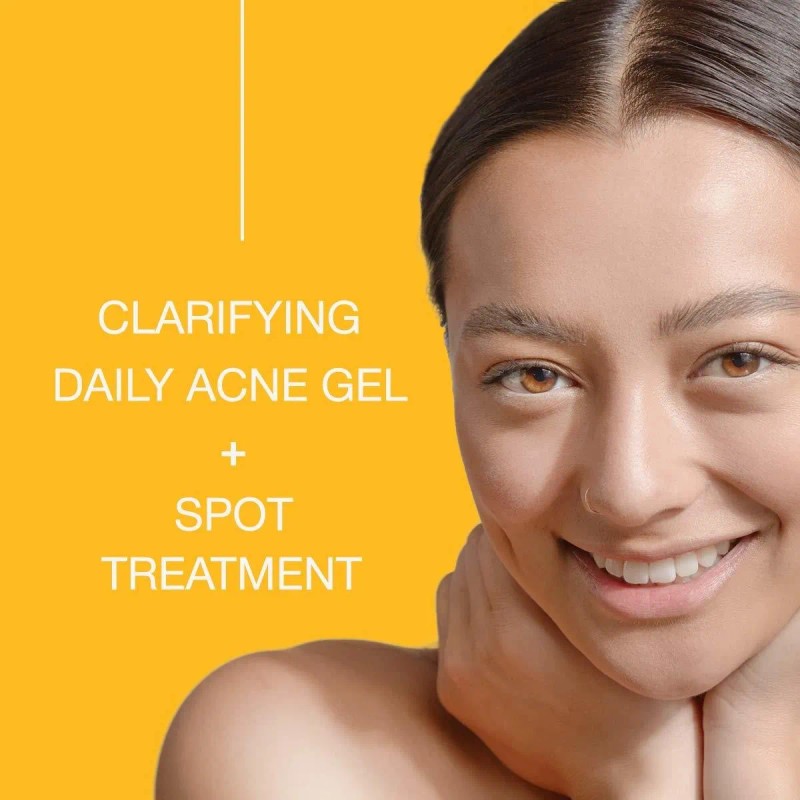 Toque Peróxido De Benzoilo 2,5% Acne Treatment Gel Crema -