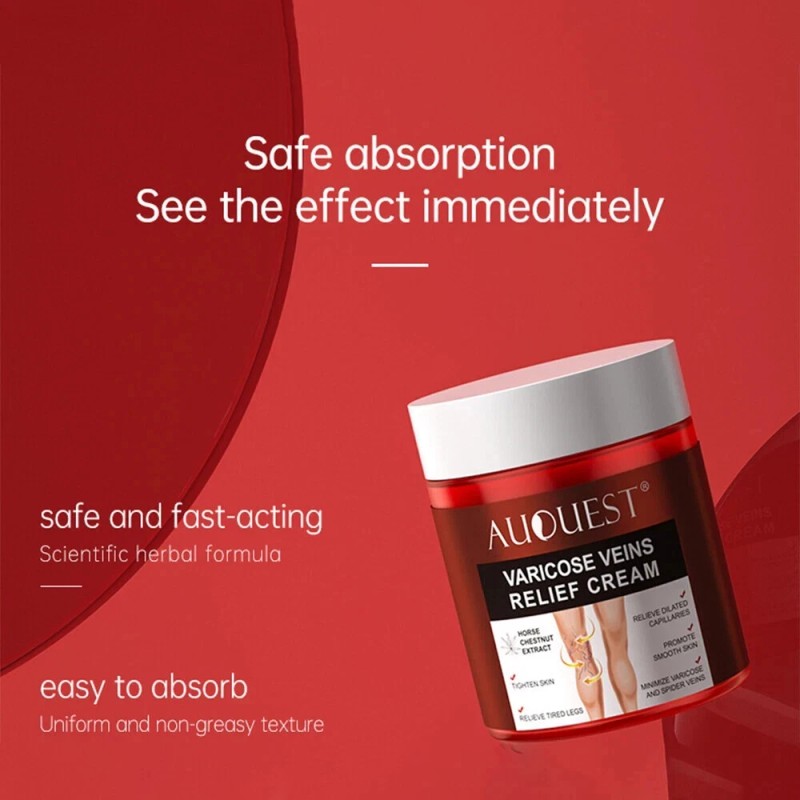 Varicose Veins Relief