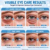 Caffeine Eye Serum with 360° Cooling Roller, Under Eye Serum