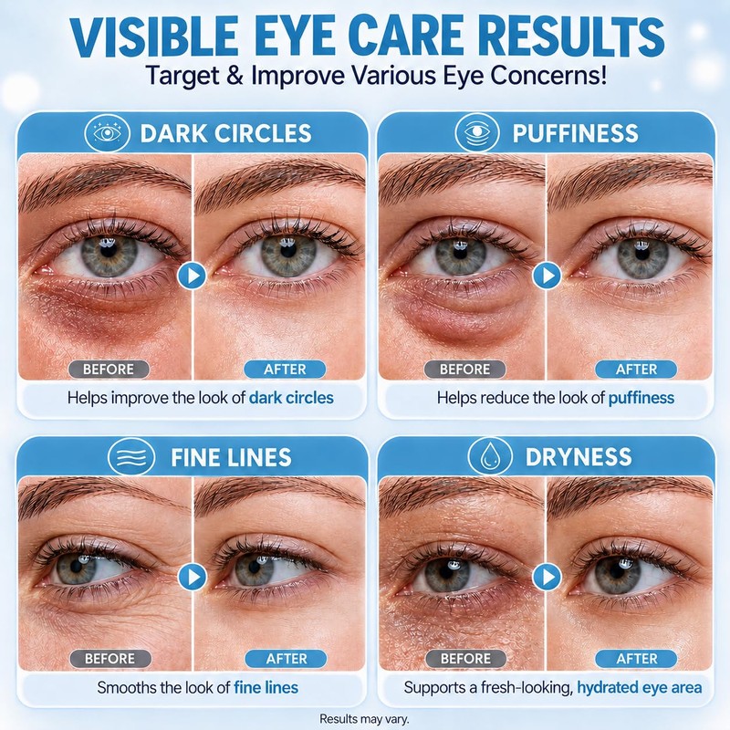 Caffeine Eye Serum with 360° Cooling Roller, Under Eye Serum