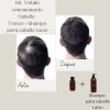Paquete Tónico Y Shampoo Para Cabello Lacio Tónico Vittale