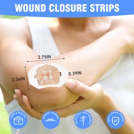 AUSLKA Butterfly Bandaids Wound Closure Strips - 4 Pcs Zip Stitch Wound Closure Strips - Emergency Laceration Closures - Liquid Stitch - Cut, Incision, Tear, Post Surger