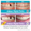 ORVANCE Aligner Pontics - Light Shade (16 Count) | Fills