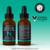 Serum Niacinamida 10% Quotidien Con Zinc + Planta De La