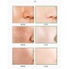 Mascarilla Max, Mascarilla En Barra, Té Verde, Antiacné, Lim
