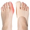 flintronic Hallux Valgus Correction, 2 Pieces Toe Separator, Hallux Valgus