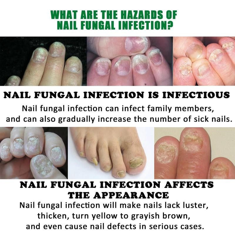 Ginger nail treatment nail support nail care Moisture Blend Cosmetic