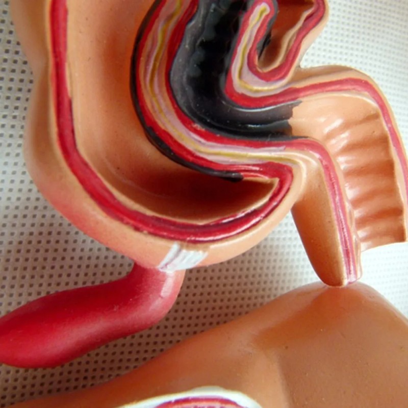 Modelo Didáctico, Modelo De Anatomía Visceral Del Intestino