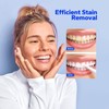 SmileShark Premium Teeth Whitening Pens (4 Count), Sensitive-Free Whitening Gel,