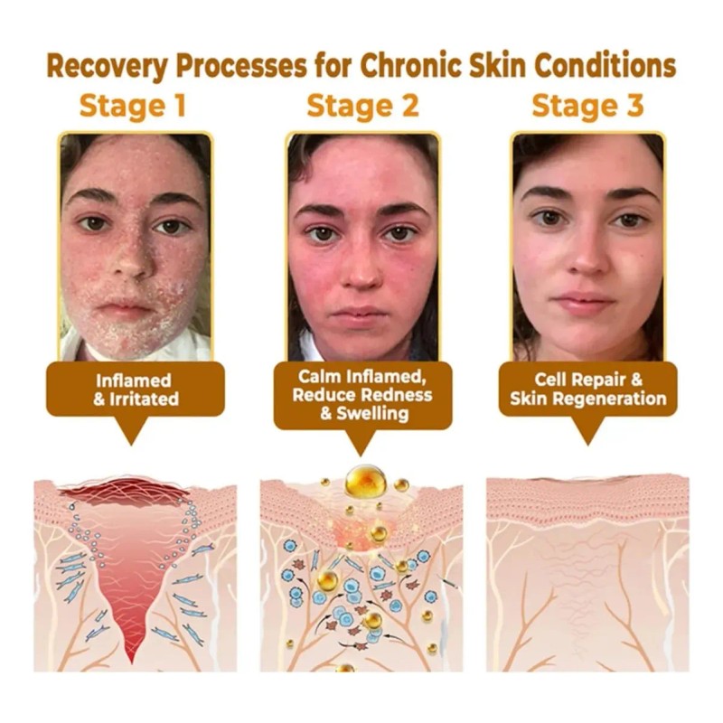 Crema Reparación Rápida Piel Abeja Awzlove